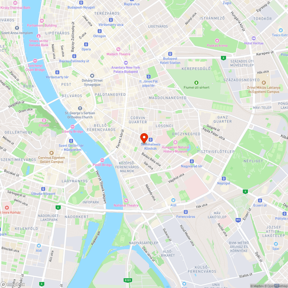 Salkaházi Sára parknál térelválasztó oszlopok kiszedve bejelentés helye